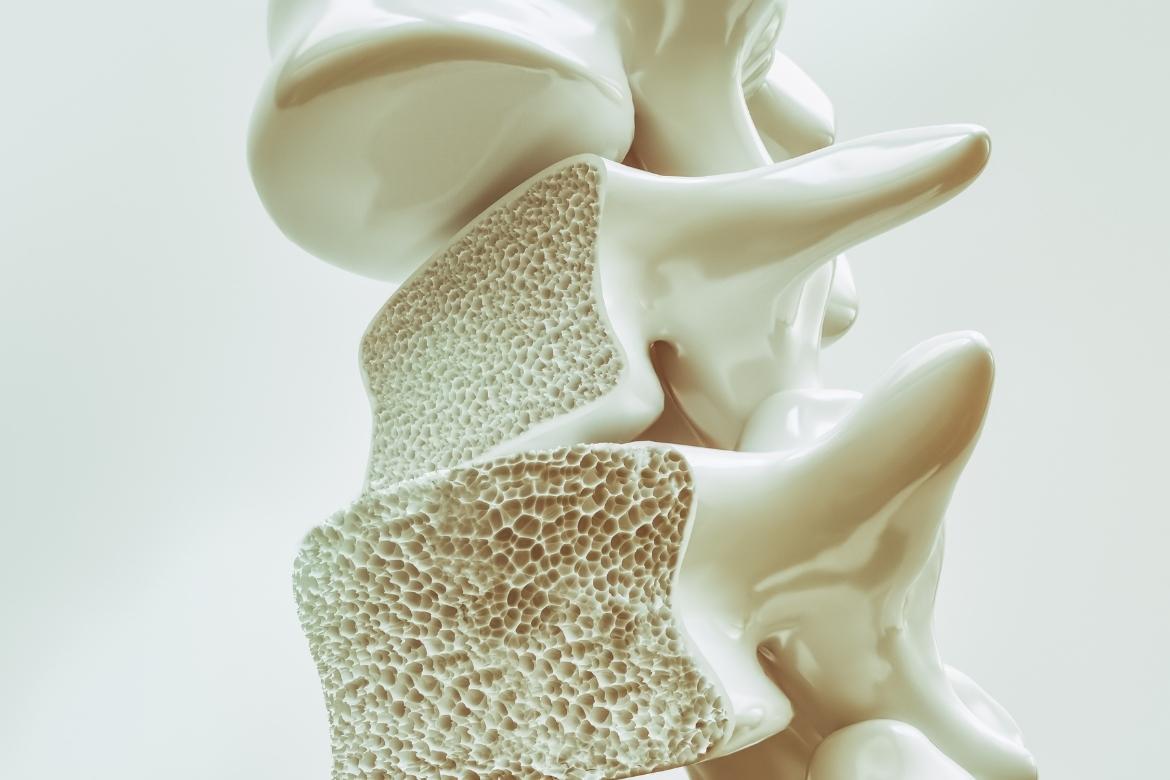 licopene e osteoporosi