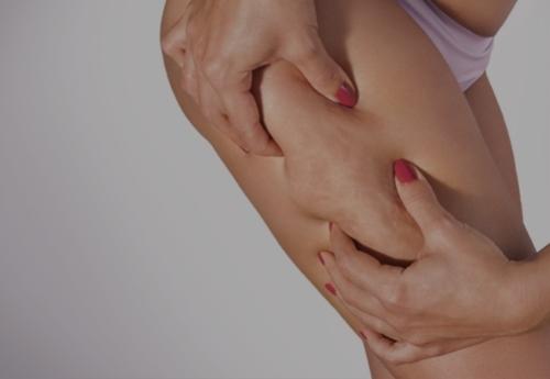 Progetto bioniporine licofarma
